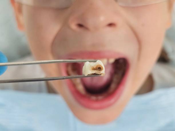 Best After-Hours Emergency Dentist in Tuscumbia, AL